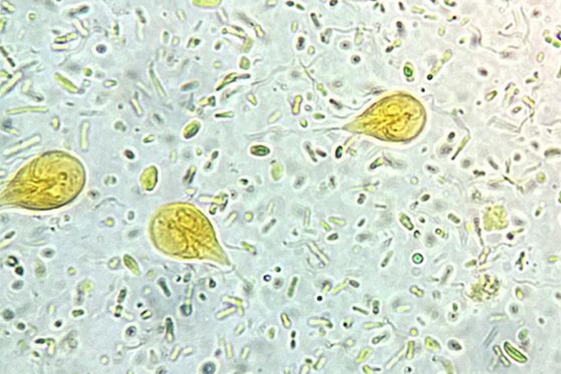 <p>Giardia lamblia / intestinalis / duodenalis</p><p>Troph= 10-20 um</p><p>Cyst= 11-14 um</p>