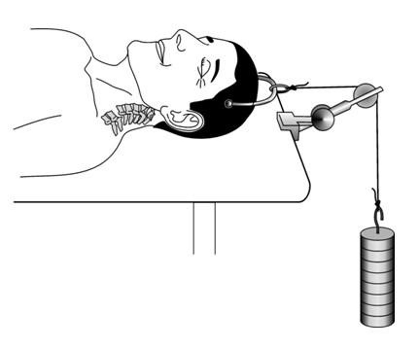<p>To immobilize the fracture and maintain proper alignment.</p>