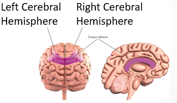 <p>Forward part of the brain that allows advanced intellectual abilities</p><ul><li><p>Most highly developed area of the human brain</p></li><li><p>Consists of 2 hemispheres, which communicate and cooperate</p></li><li><p>Includes most of the limbic system, basal ganglia, olfactory bulb, and cerebral cortex</p></li></ul><p></p>