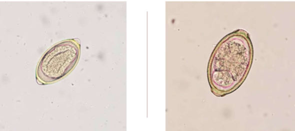 <p>are <span>Eucoleus böehmi zoonotic </span></p>