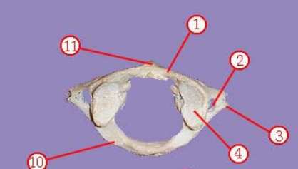 <p><span>Name this specific vertebra</span></p>