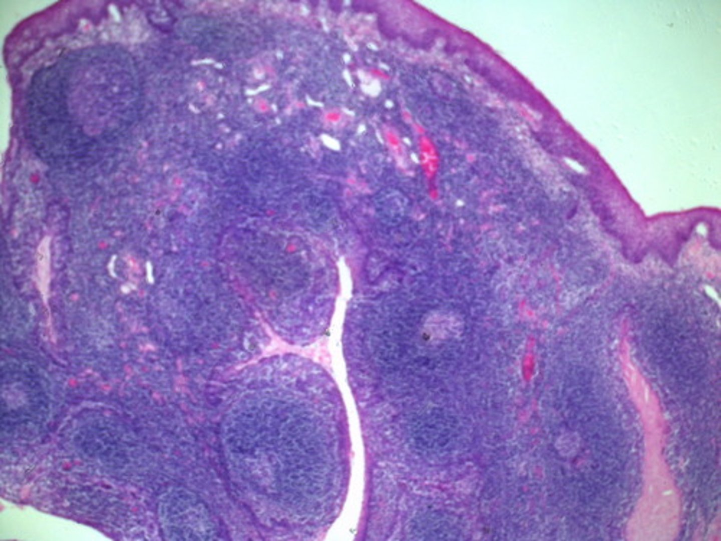 <p>Identify the entire tissue or organ.</p>