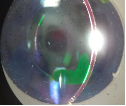 <p>what slit lamp technique is being demonstrated on the model eye in this image</p>