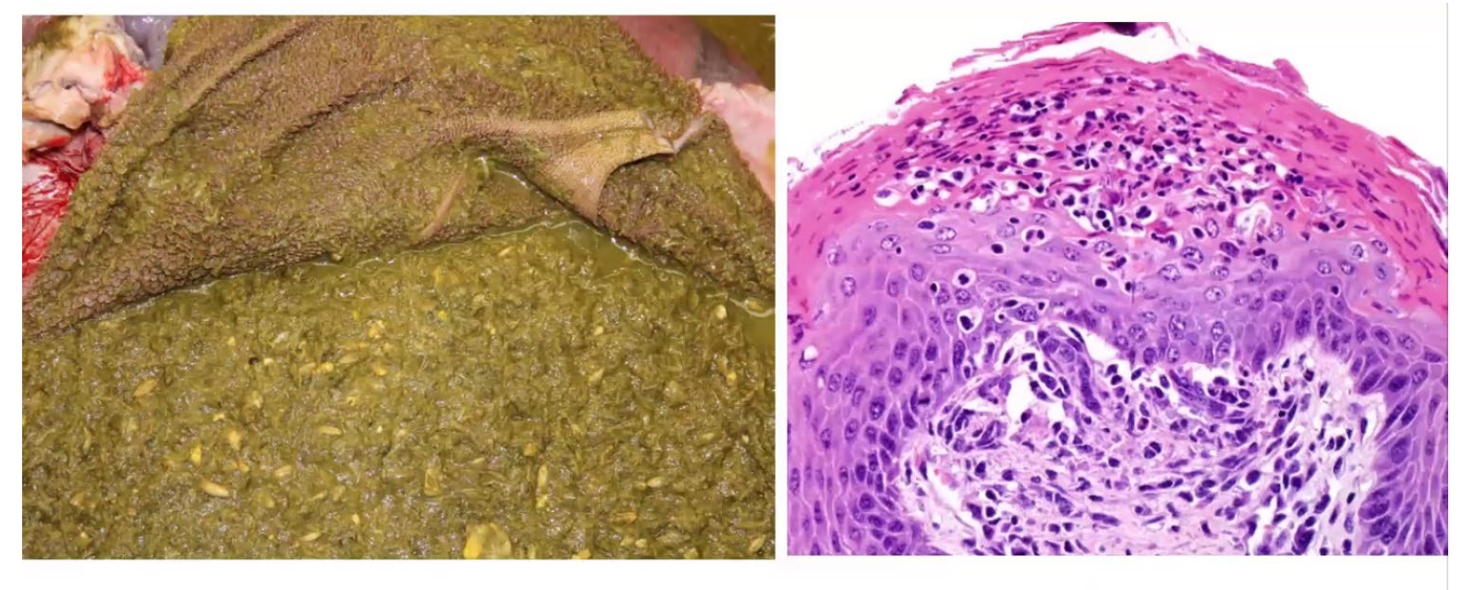 <p>What is the condition? ~</p><p>A-Zygomycosis</p><p>B-Bovine viral diarrhea</p><p>C-Ruminal acidosis</p><p>D-Necrobacillosis</p>