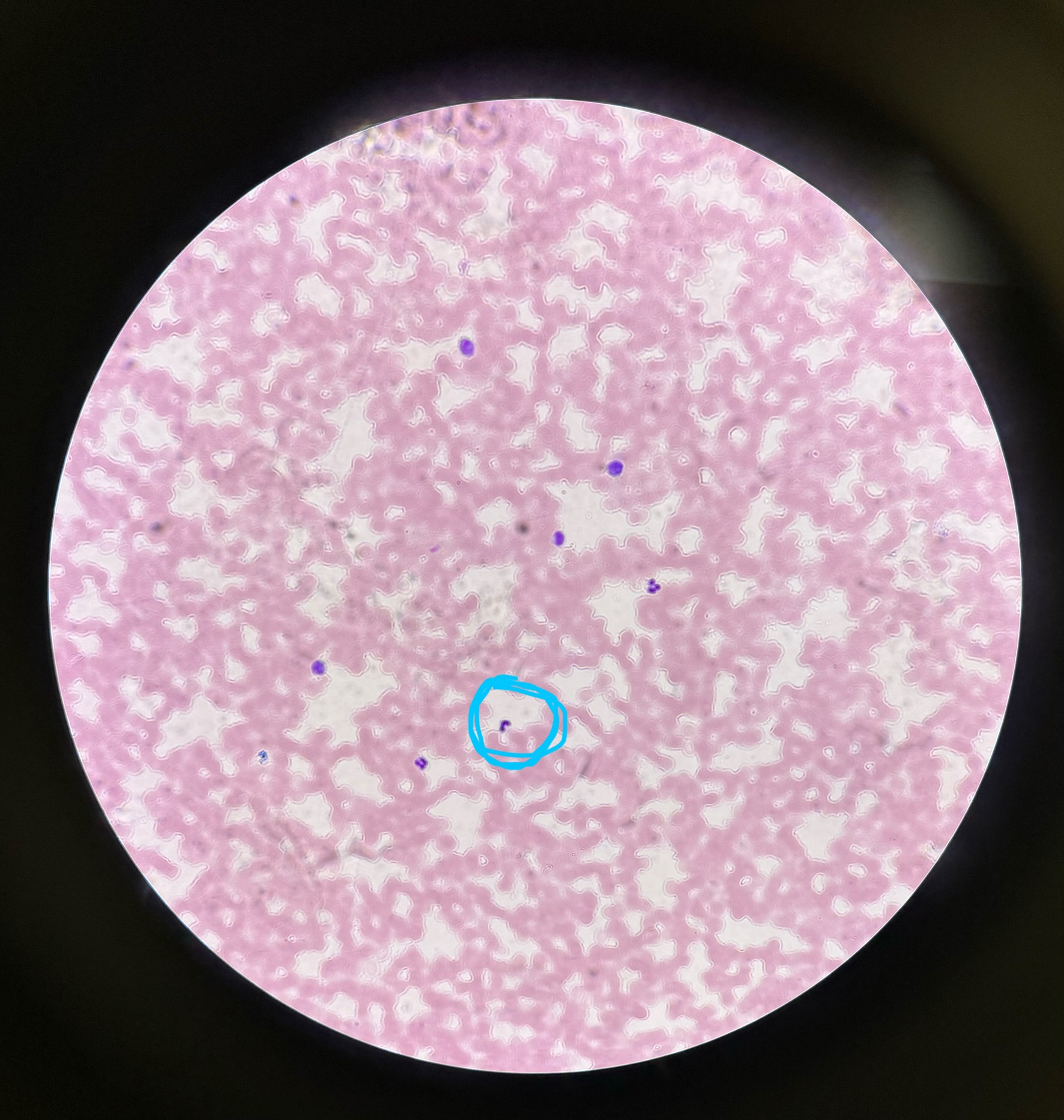 <p>What is being circled (view closely)?</p>