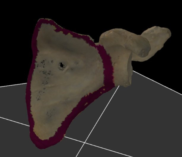 <p><span>volledige voorzijde van de scapula</span></p>