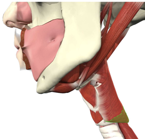 * Made up of cricopharyngeus muscle and cervical esophageal muscle
* Zone of high pressure that separates the pharynx from the esophagus (3-4 cms vertically)
* Sits tonically contracted at rest
* Stops air entering esophagus
* Stops stomach contents entering pharynx
* Innervated by vagus nerve and pharyngeal plexus
* Lots of negative pressur underneath the UES

\
