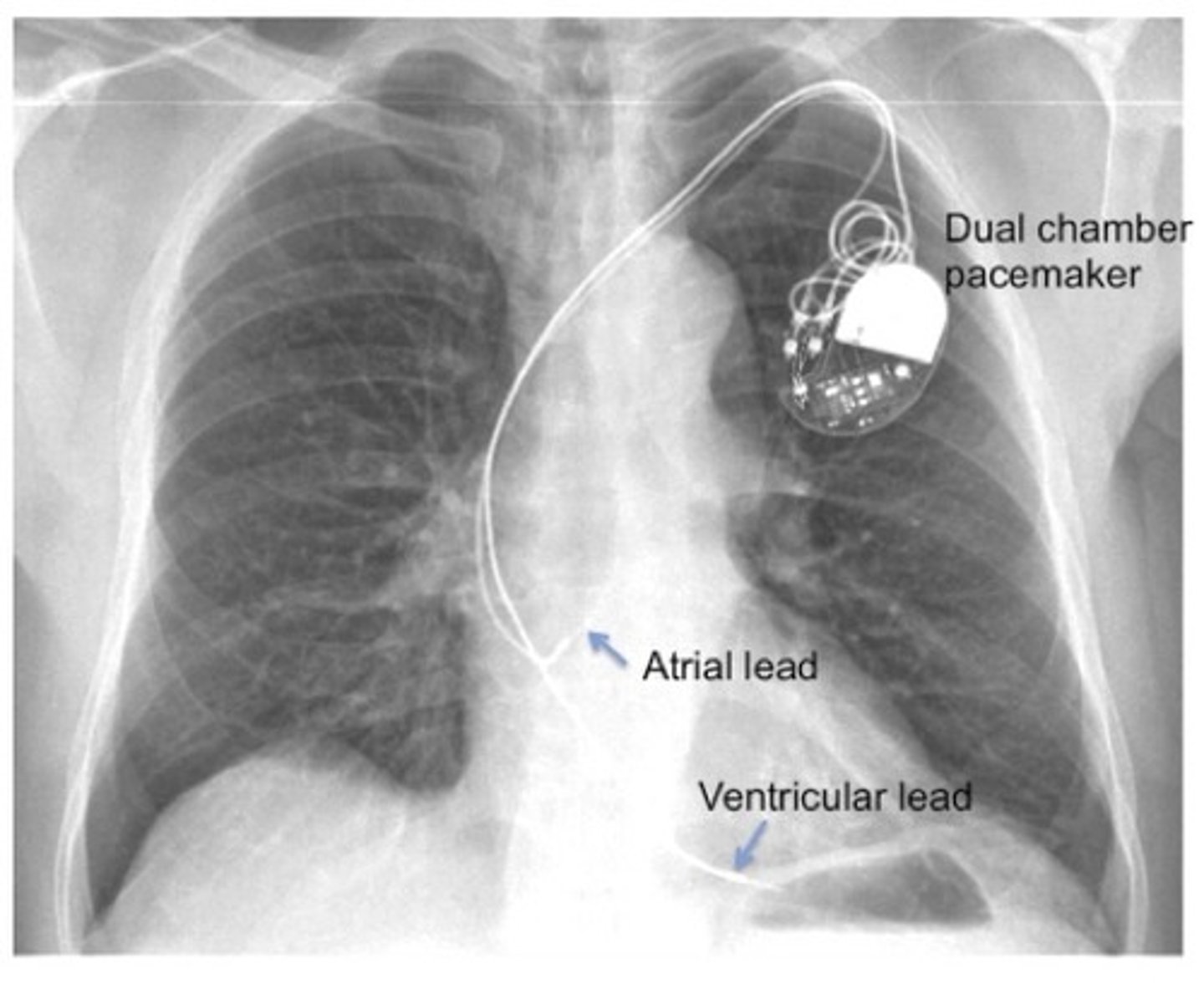 <p>What procedure?</p>