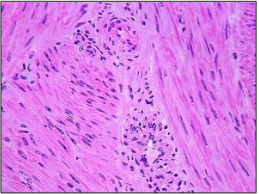 <p><span>What type of muscle tissue is this?</span></p><p><span>Is this tissue considered striated muscle?</span></p><p><span>Is this tissue considered multinucleate?</span></p><p>Is this voluntary muscle tissue?</p><p><span>Where is this type of muscle found in the body?</span></p>
