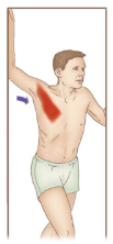 <p>This self-stretch for the right pecs stretches what specifically?</p>