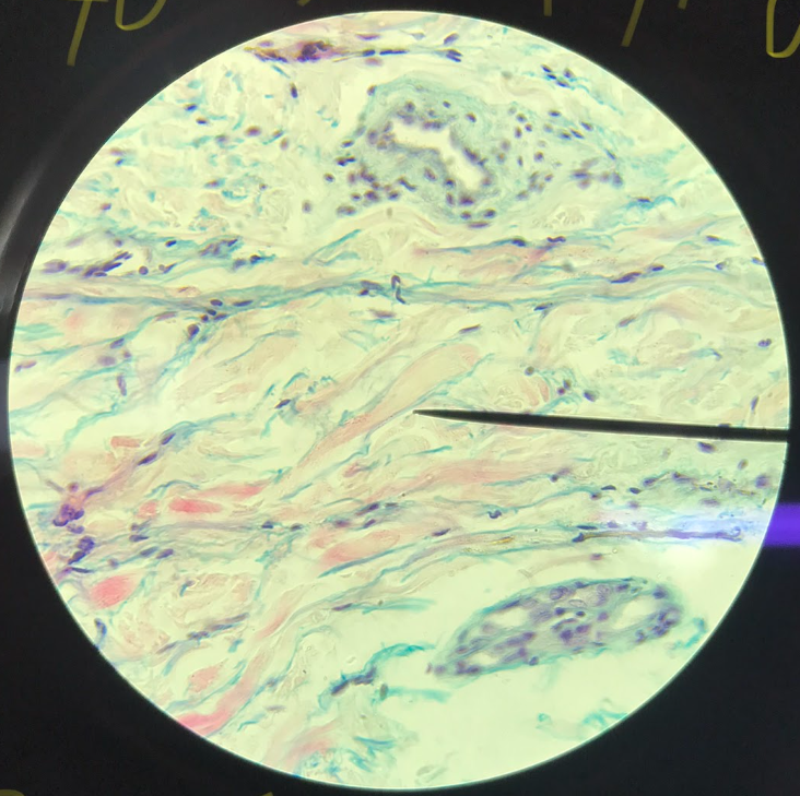 <p>dermis; pinkish bundles of fibrillar structures are the collagenous fibers; small, dark blue in color are the nuclei of fibroblasts</p>