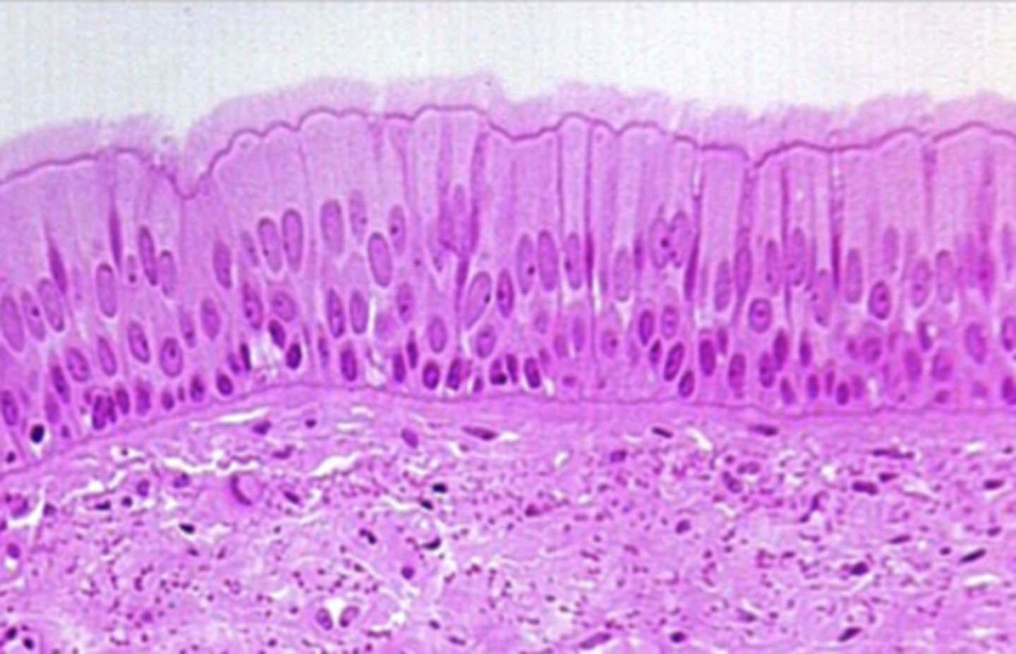 <p>Secretes and moves mucus via cilia; protection — Ciliated type lines trachea and upper respiratory tract; non‑ciliated in epididymis</p>