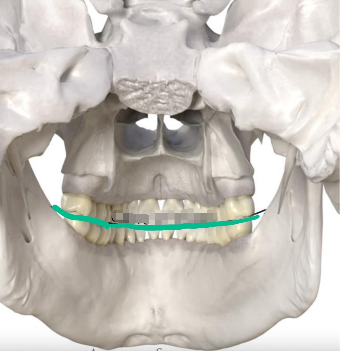 <p>Medial/lateral curvature of occlusal plane of <strong>posterior teeth</strong></p><ul><li><p>2-dimensional</p></li><li><p>Opposite direction of Curve of Spee</p></li><li><p>Allows for sphere of motion in chewing</p></li></ul><p></p>