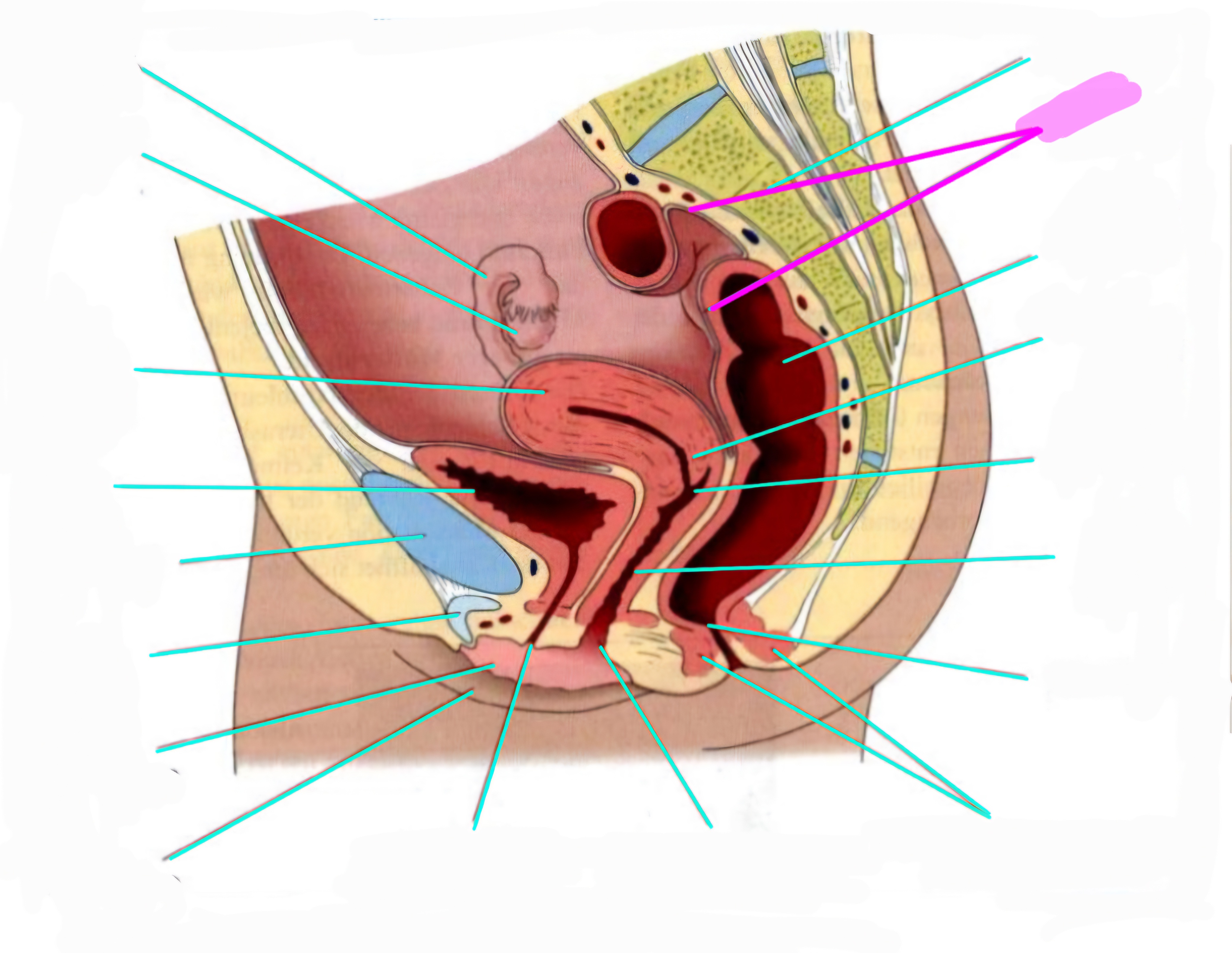 term image