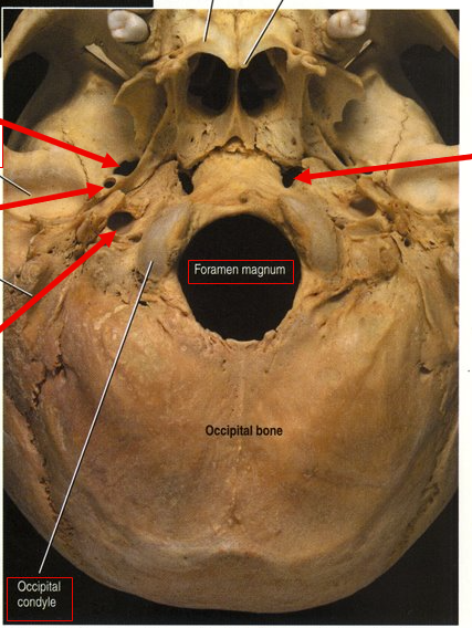 <p>What is the top left arrow?</p>