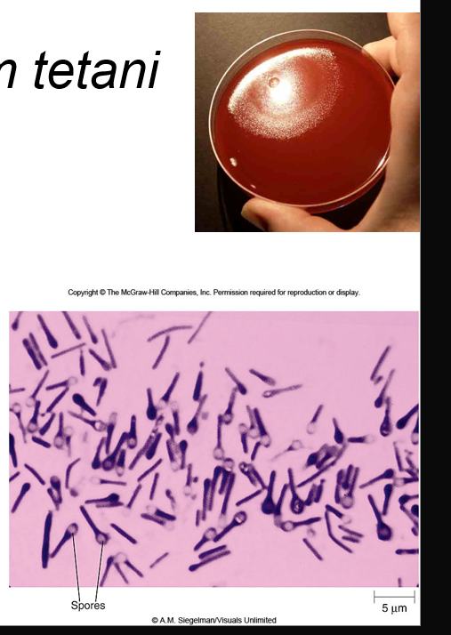 <ul><li><p>GPB</p></li><li><p>produces <strong>terminal spherical</strong> swollen spores (drumstick, tennis racquet, lollipop)</p></li><li><p>slow grower</p></li><li><p>swarming growth on lab media </p></li><li><p>rarely isolated </p></li></ul><p></p>