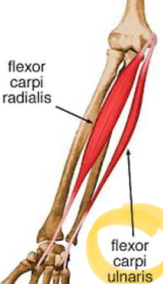<p>Flexor carpi ulnaris.</p>