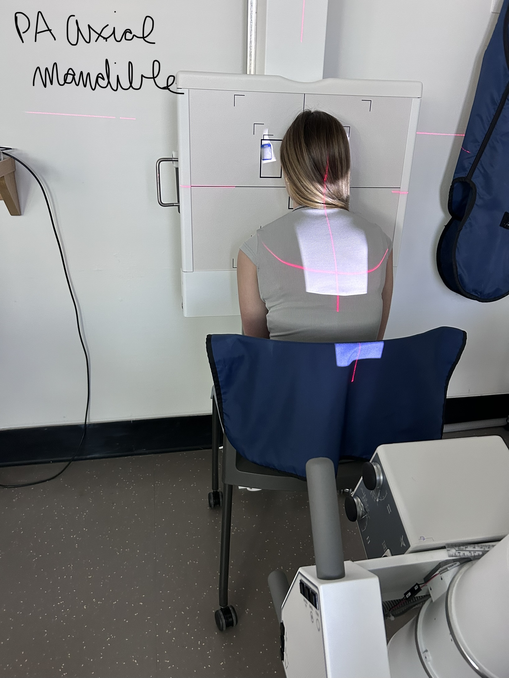 PA Axial Mandible (Ramus)