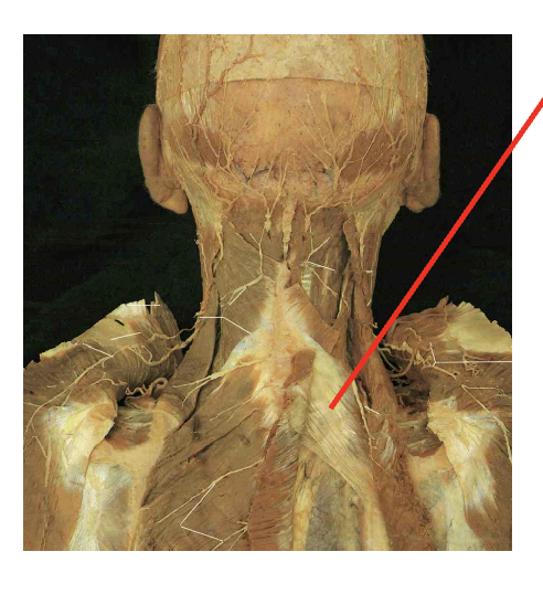 <p>what is this muscle. What is its origin. Where does it inserts. </p>