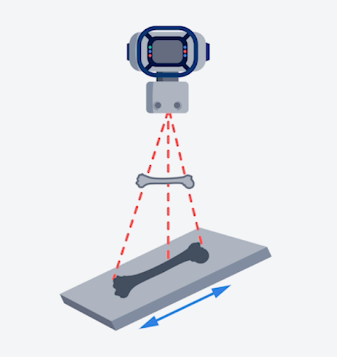What type of distortion is represented in the following illustration?