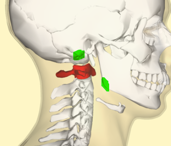 <p>Lateral masses.</p><ul><li><p>palpable between mastoid process of temporal bone and angle of the mandible </p></li></ul><p></p>