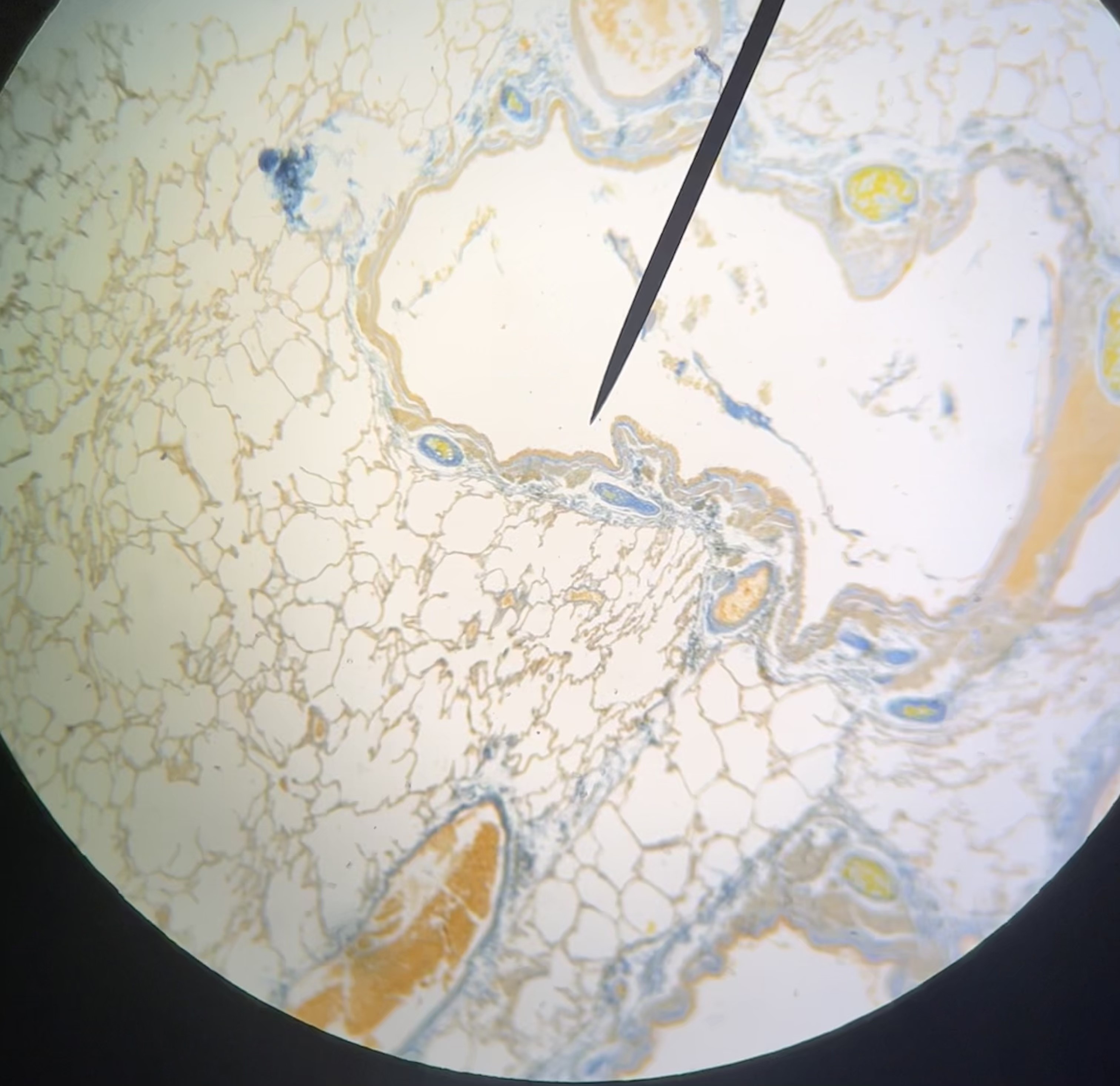 <p>simple squamous epithelium</p>