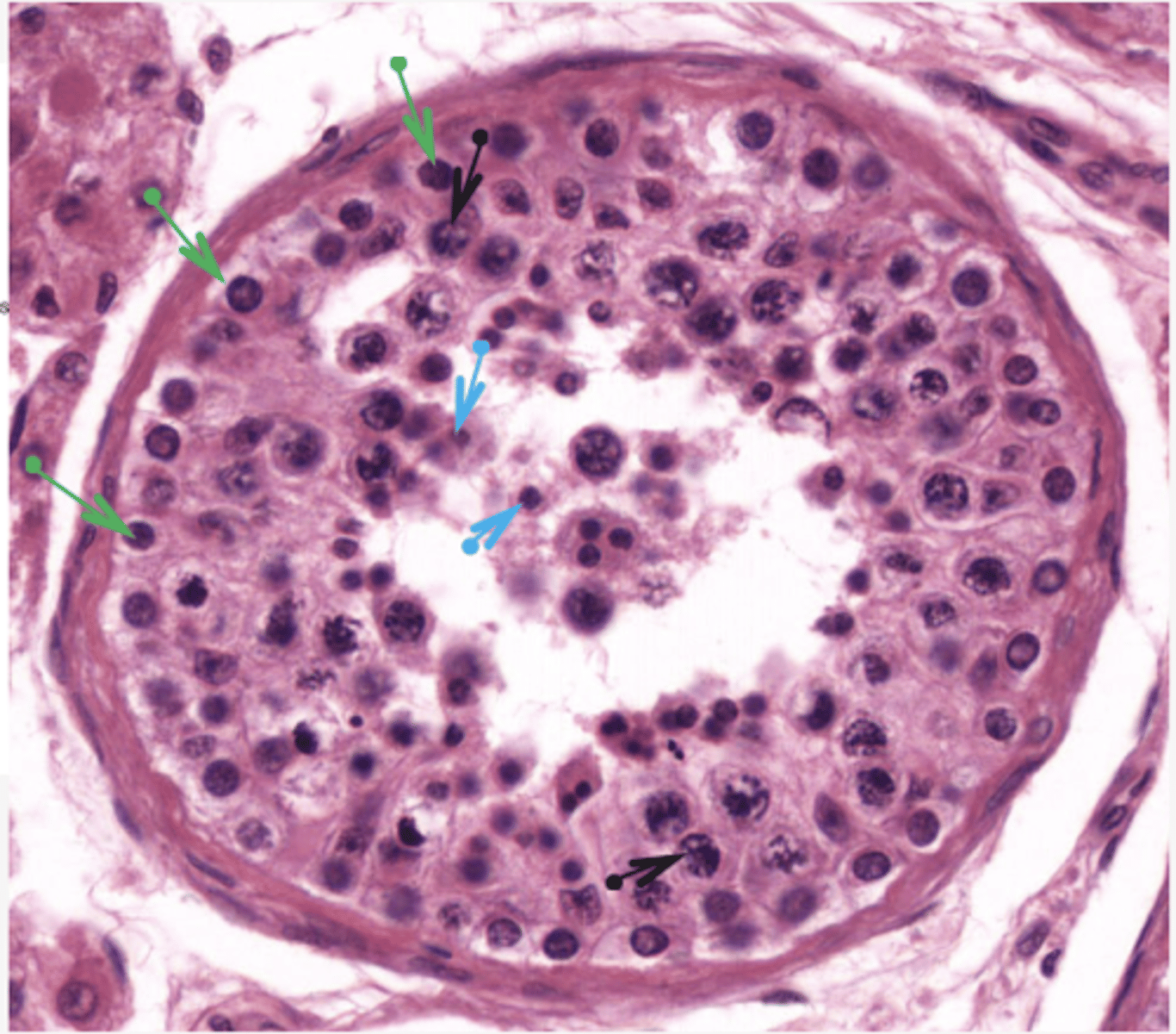 <p>Identify the cells (BLUE ARROW)</p>