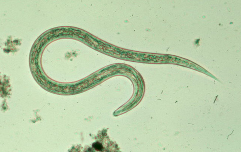 <p>zoonotic, in dogs, small animals, human feces</p><p>dermatitis, anemia, respiratory damage</p><p>tropic/subtropics, warm regions</p>