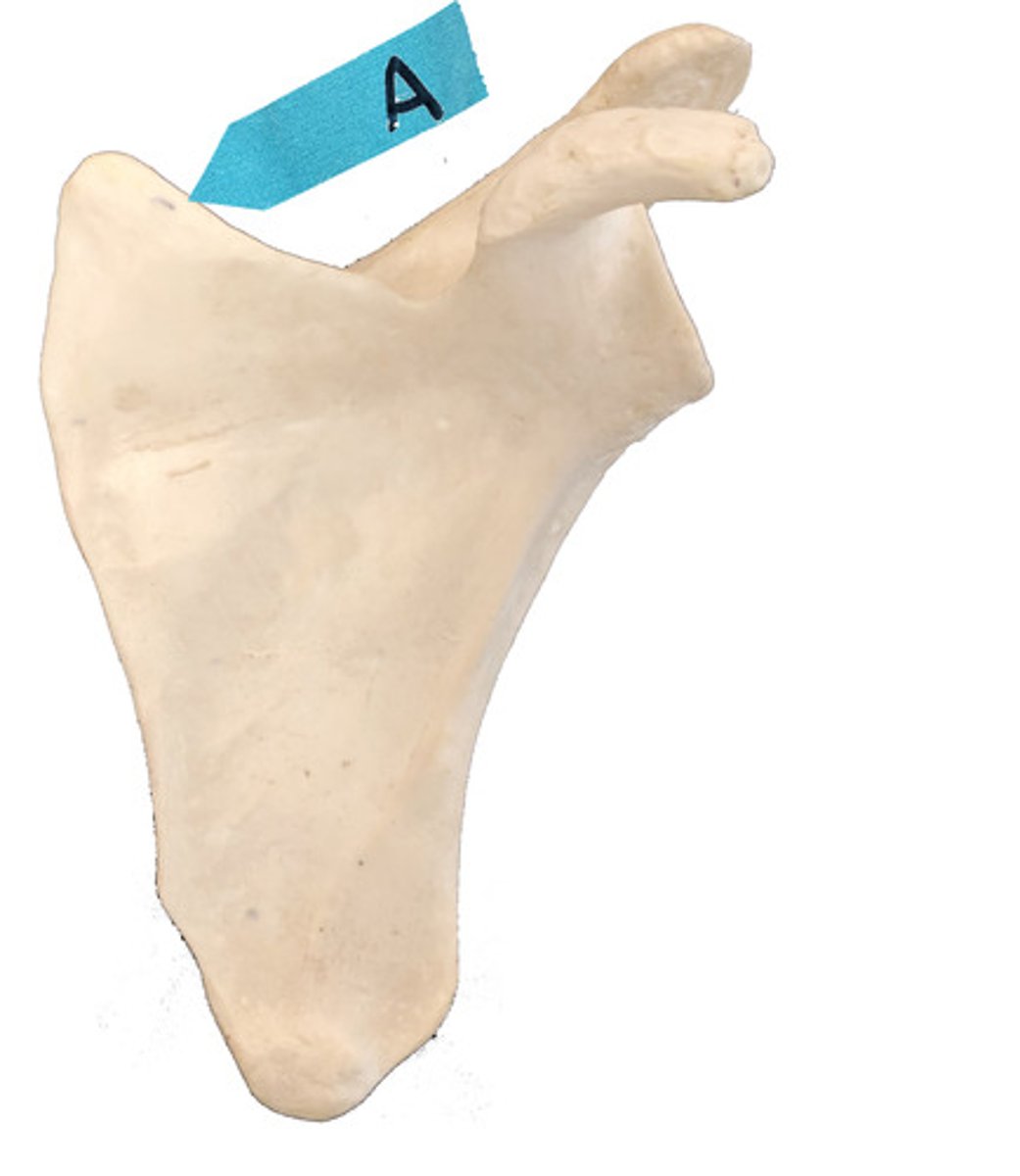 <p>Identify this bone marking.</p>