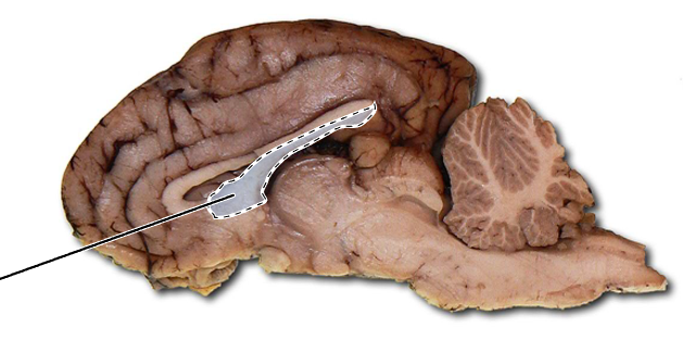 <p>Name the part of the brain that is highlighted.</p>
