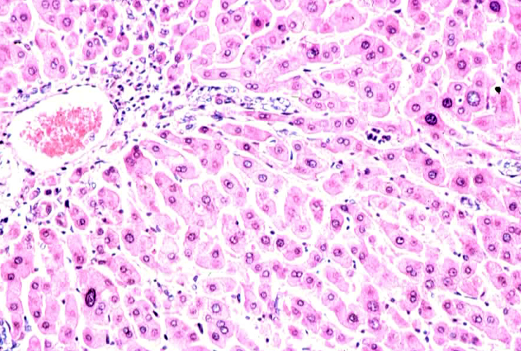 <p>Which of these is the <strong>best </strong>definition of pleomorphism?&nbsp; (it can be visualized in the photo, which is from the liver of a woodchuck!)</p>