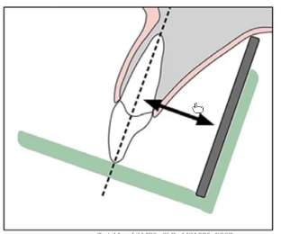 <ul><li><p>the object-to-receptor distance should be optimised based on the procedure</p></li><li><p>keep in mind technique and positioning for this</p></li></ul><p></p>