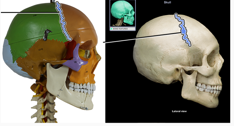 <p>The frontal and parietal bones are connected by a fibrous joint called the ____ ______</p>