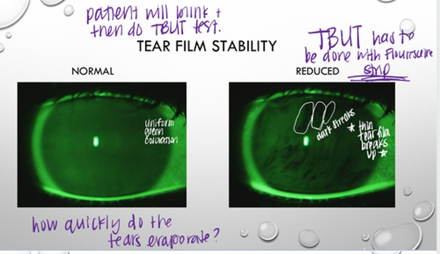 <p>What is the TBUT test measure?</p>
