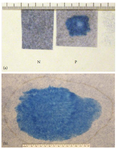 Amylase colorimetric assay using Phadebas reagent. (a) A spot test for saliva and (b) amylase mapping result showing a saliva-stained area. N, a negative result; P, a positive result.