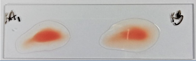 <p>Identify the:</p><ul><li><p>Blood Group</p></li><li><p>Antibody/Antibodies Present</p></li><li><p>Antigen(s) Present</p></li></ul><p></p>