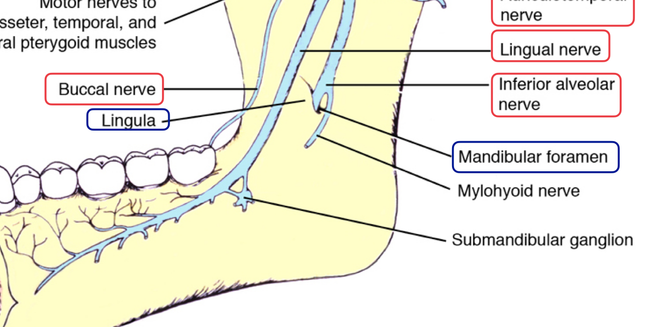 <p>lingula = bony prominence of mandibular foramen where IAN enters, protects nerve </p>