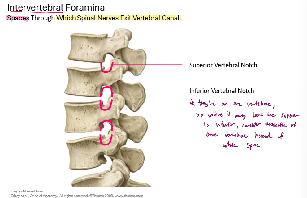 <p>*They’re on one vertebrae, so while it may look like superior is inferior, consider the perspective of one vertebrae instead of the whole spine!</p>