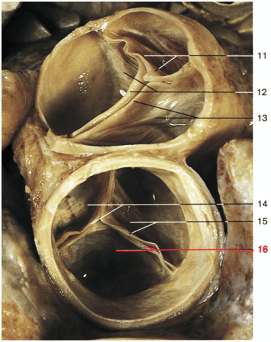 <p>Name the Structure of the Left Ventricle</p>