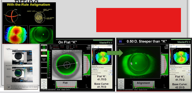 <ul><li><p>Helps predict pooling patterns</p></li><li><p>Does not account for lid involvement</p></li></ul><p></p>