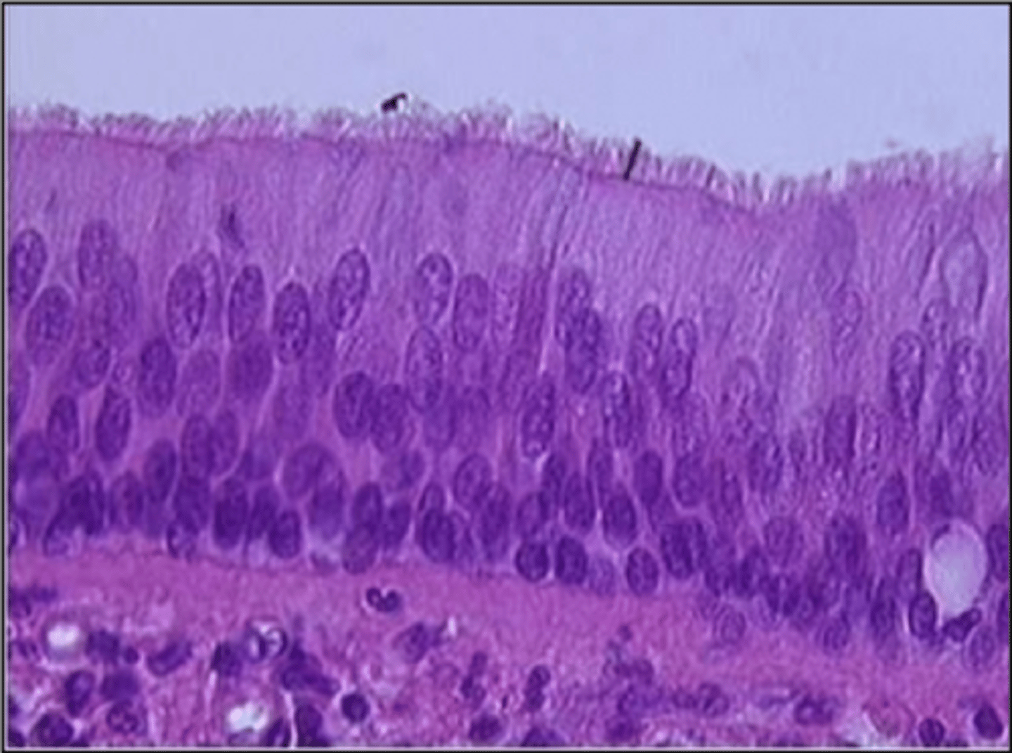 <p>what is this type of tissue and where is it found?</p>