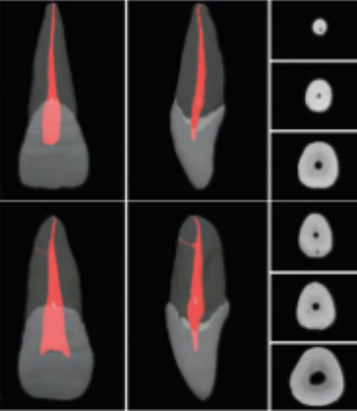 <p>triangular</p>
