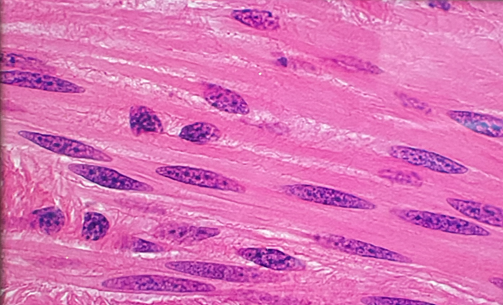 <p>What tissue muscle type is this? What is its function?</p>