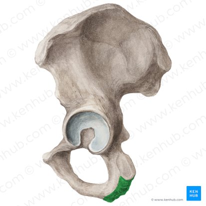 <p>Ischial _____</p>