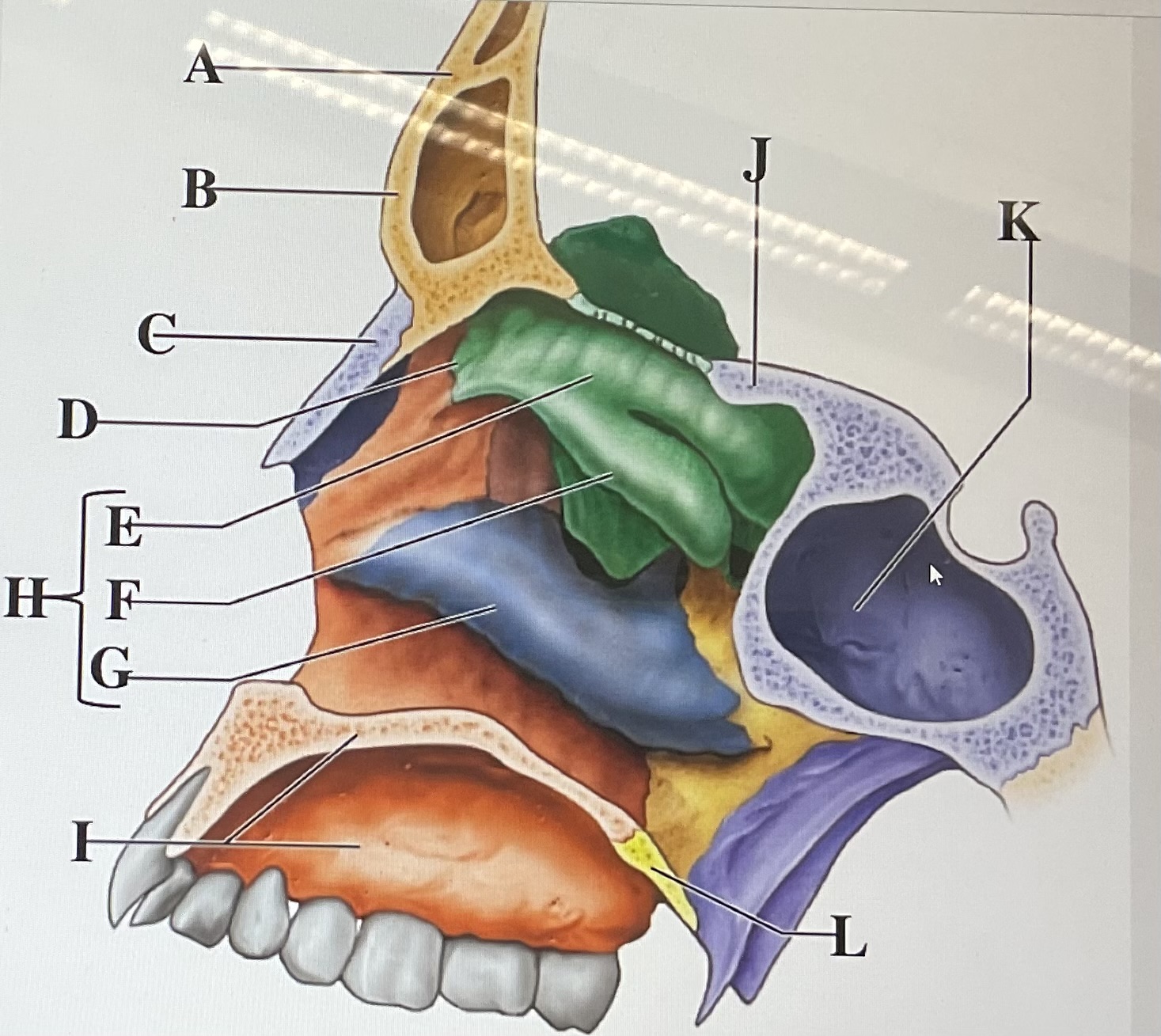 <p>in the figure above letter  is the sphenoid sinus and letter<strong> __</strong>_ is the superior nasal concha bone </p>