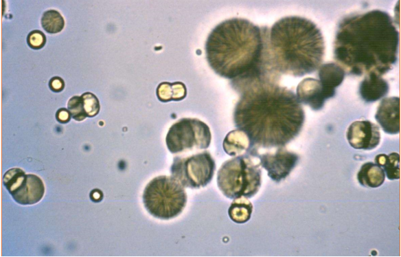 <p>Name the crystal</p>