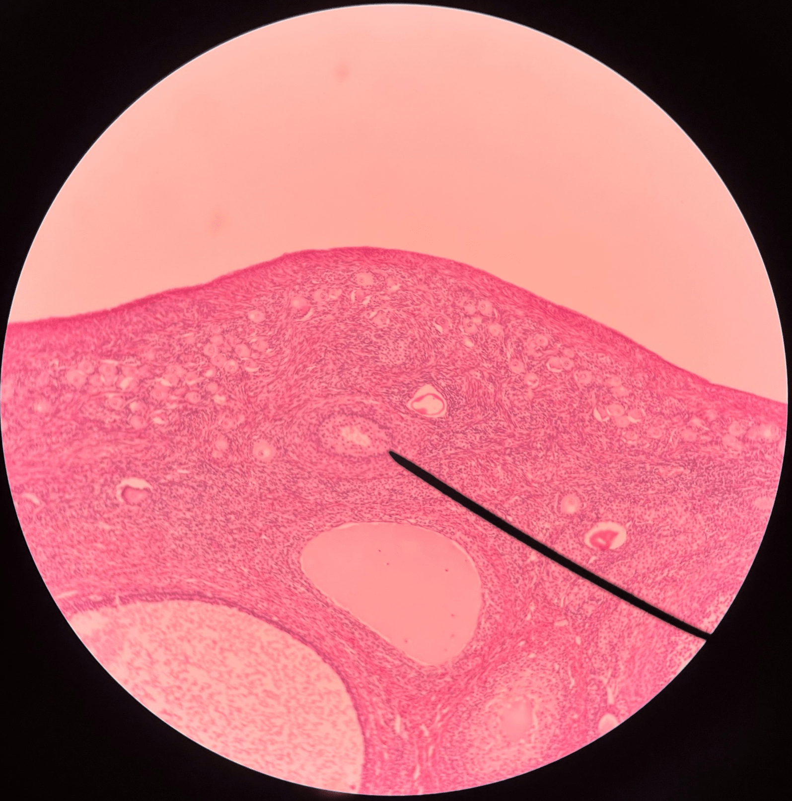 • Slide histology of the ovary.

• Appears significantly larger than a primary follicle.

• Multiple layers of cells surround the oocyte.