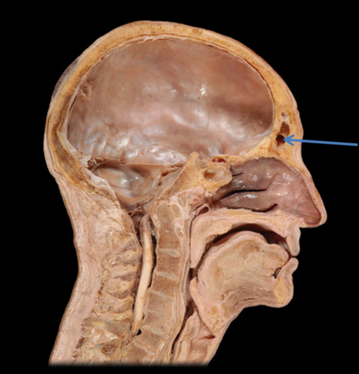 <p>Identify this space.</p>