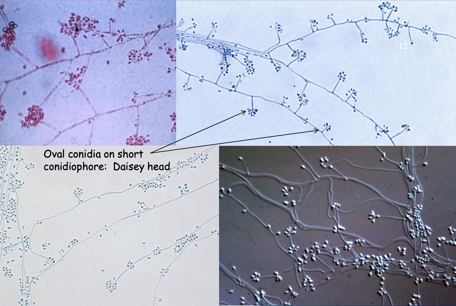 <p>Identify microscopic: Sporothrix (different growth of Sporothrix)</p>