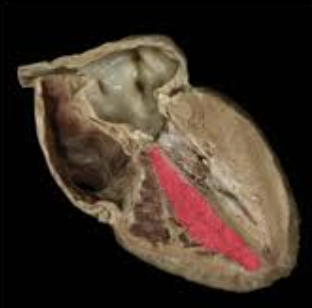 <p>a muscular partition separating the right and left ventricles, crucial for preventing mixing of oxygenated and deoxygenated blood</p>